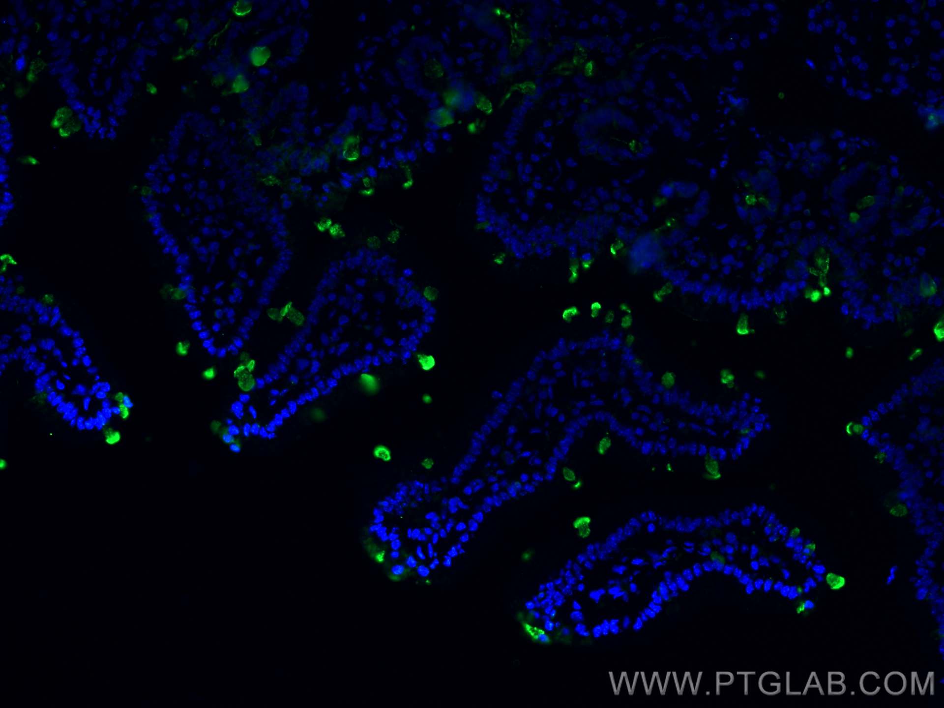 IF Staining of mouse small intestine using 17397-1-AP