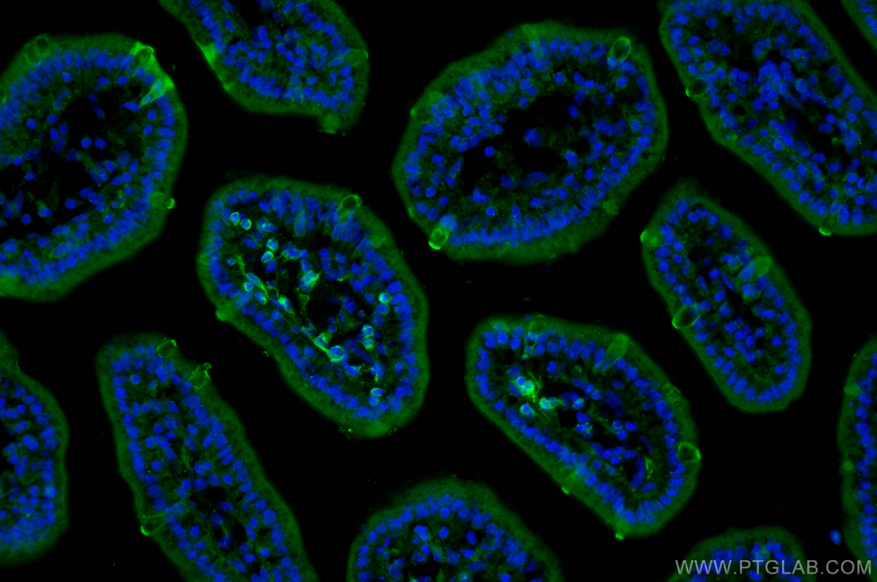 IF Staining of mouse small intestine using 17397-1-AP