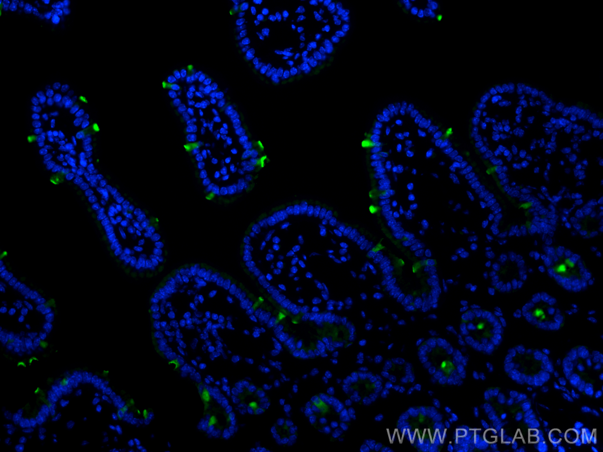 IF Staining of mouse small intestine using 17397-1-AP
