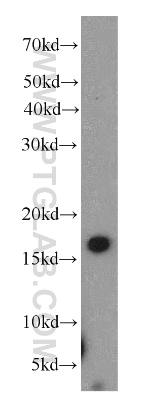 WB analysis of human colon using 17397-1-AP