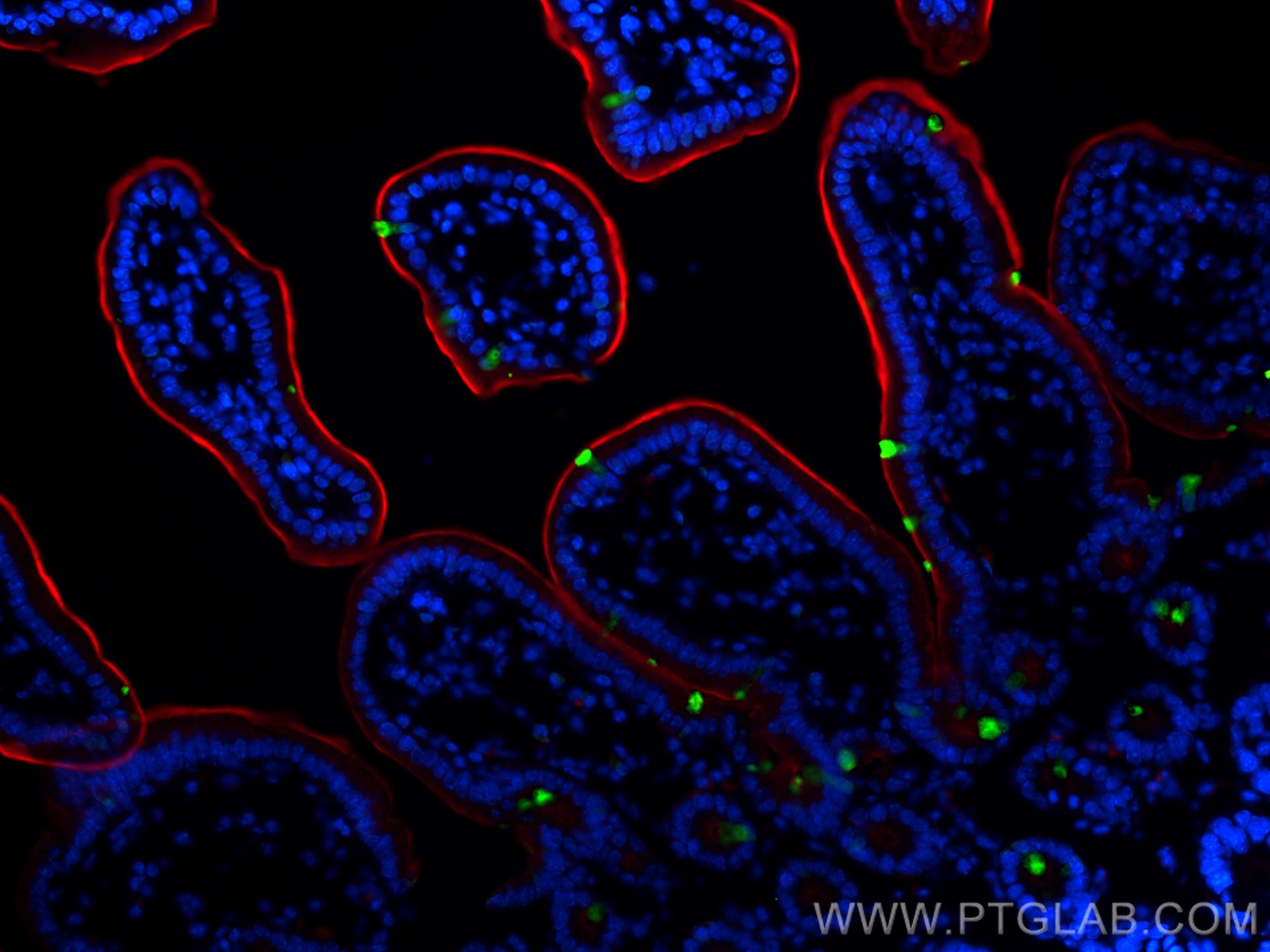 IF Staining of mouse small intestine using 67389-1-Ig