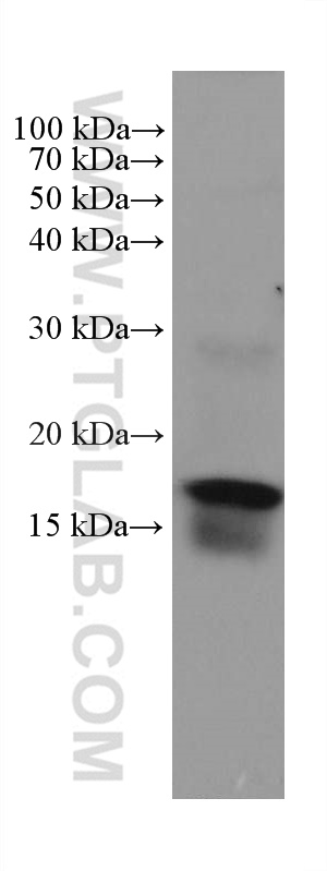 WB analysis of mouse colon using 67389-1-Ig