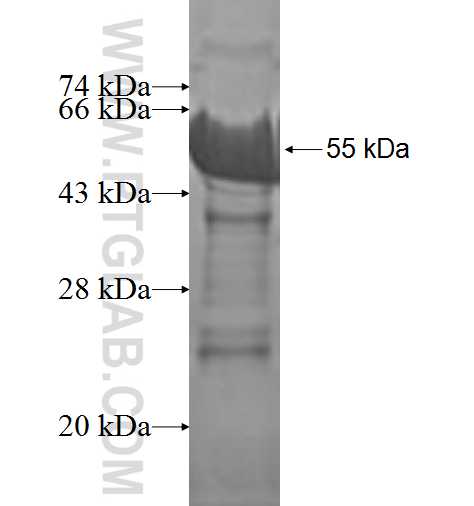 ZHD fusion protein Ag0940 SDS-PAGE ZHD fusion protein Ag0940 SDS-PAGE