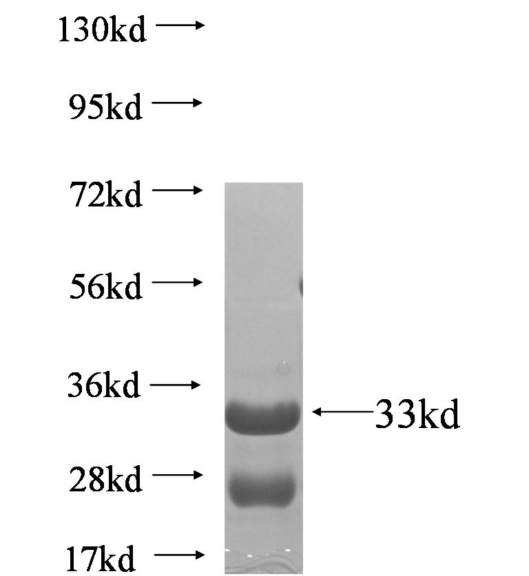 ZHX1 fusion protein Ag5580 SDS-PAGE