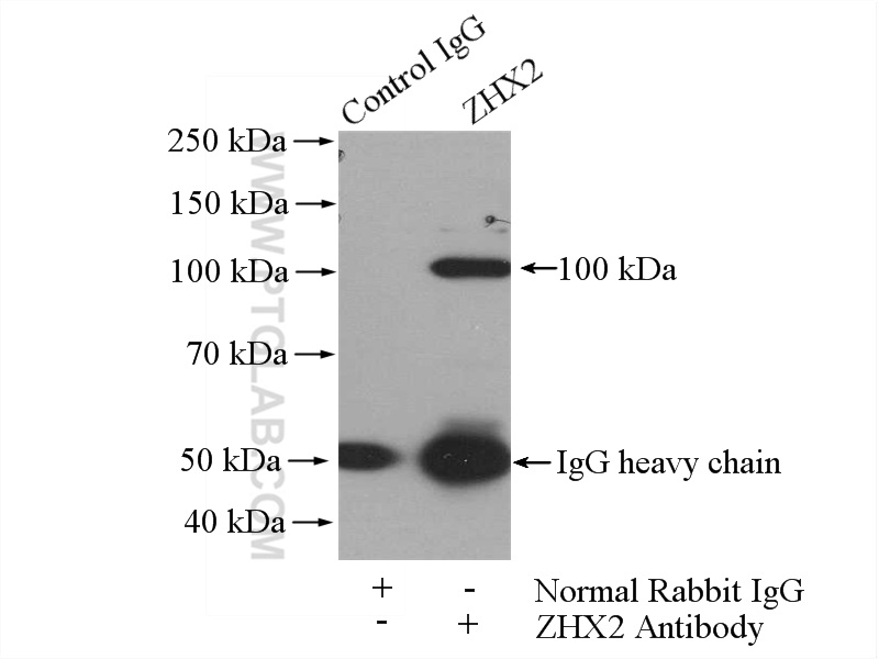 IP experiment of mouse brain using 20136-1-AP