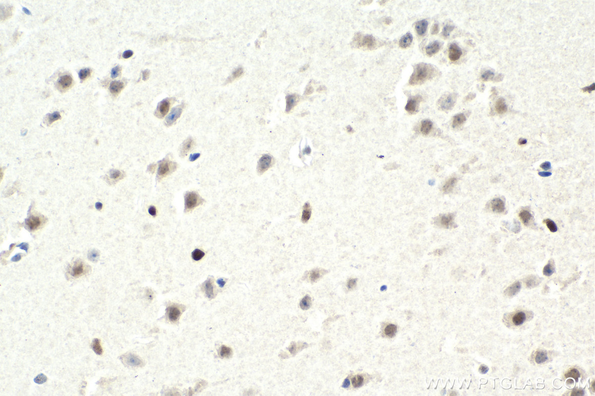 IHC staining of mouse brain using 68268-1-Ig
