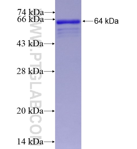ZHX2 fusion protein Ag14088 SDS-PAGE