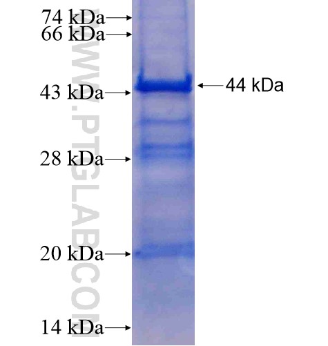 ZHX2 fusion protein Ag14420 SDS-PAGE