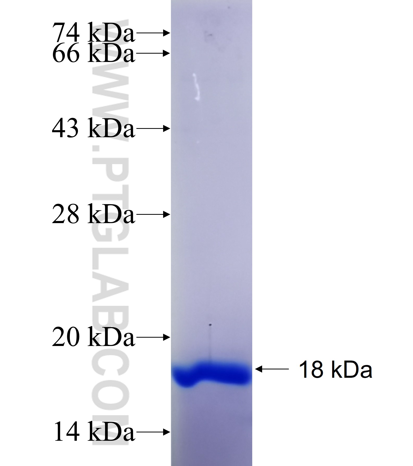 ZIC2 fusion protein Ag35844 SDS-PAGE ZIC2 fusion protein Ag35844 SDS-PAGE