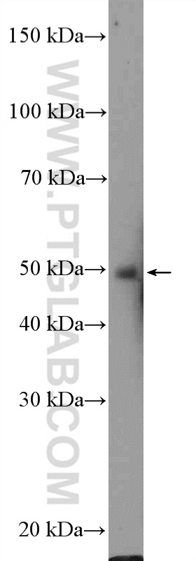 WB analysis of Neuro-2a using 21717-1-AP