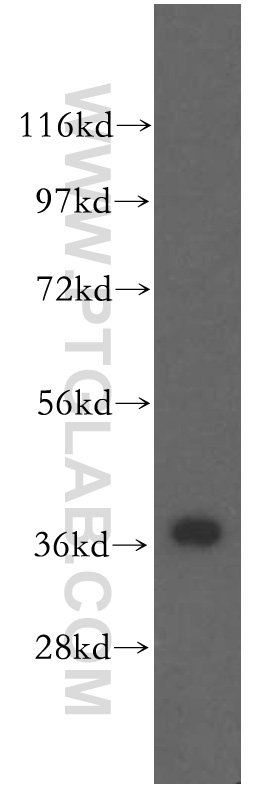 WB analysis of human brain using 51003-1-AP