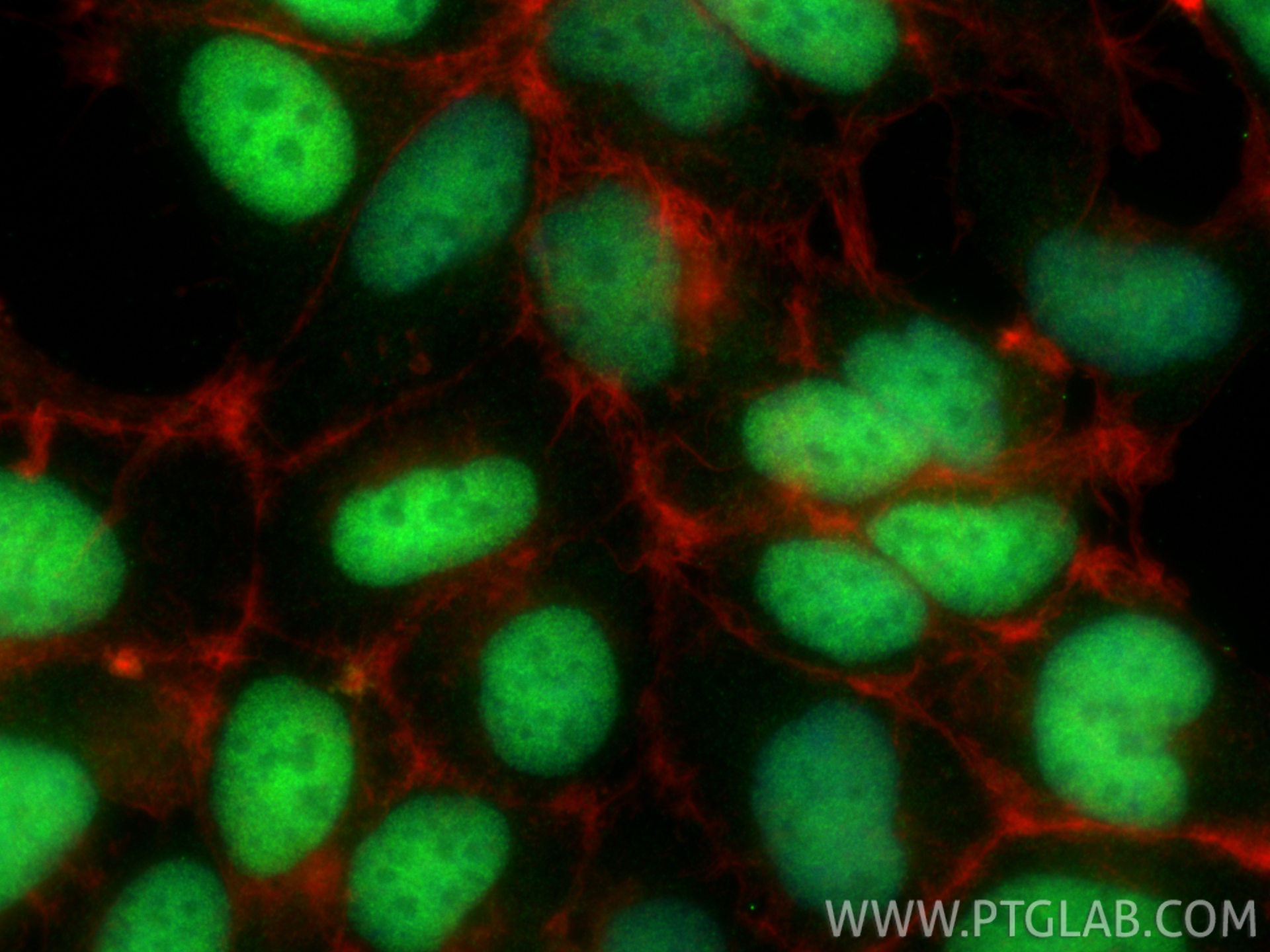 IF Staining of HEK-293 using 34277-1-AP (same clone as 34277-1-PBS) IF Staining of HEK-293 using 34277-1-AP (same clone as 34277-1-PBS)