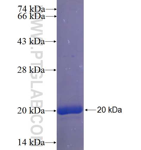 ZIM2 fusion protein Ag23353 SDS-PAGE ZIM2 fusion protein Ag23353 SDS-PAGE
