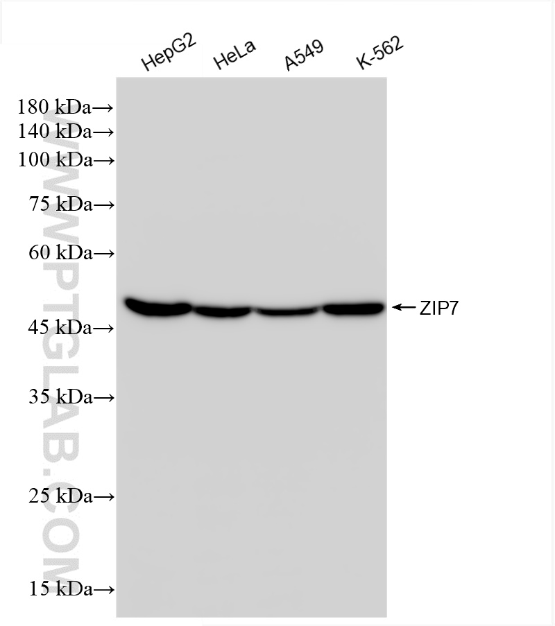 WB analysis using 85383-1-RR