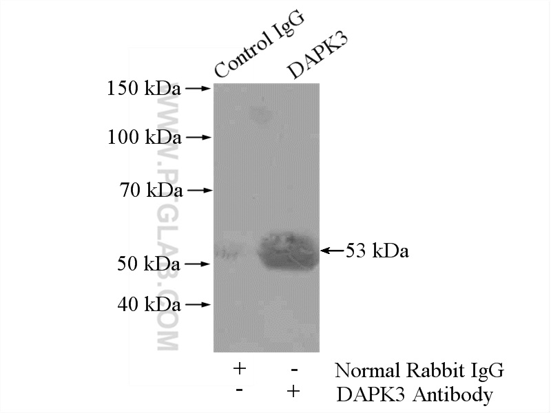 IP experiment of HEK-293 using 51021-1-AP