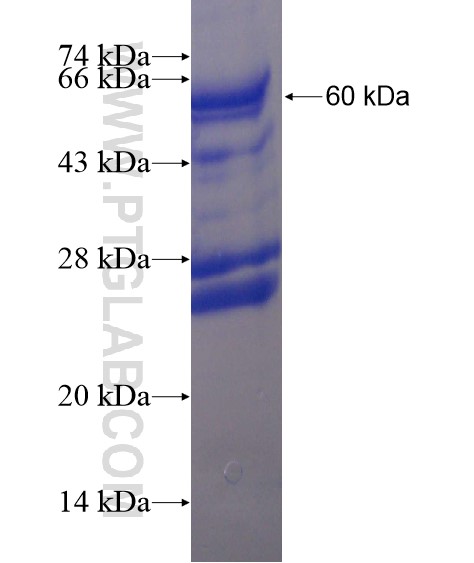 ZKSCAN1 fusion protein Ag19721 SDS-PAGE
