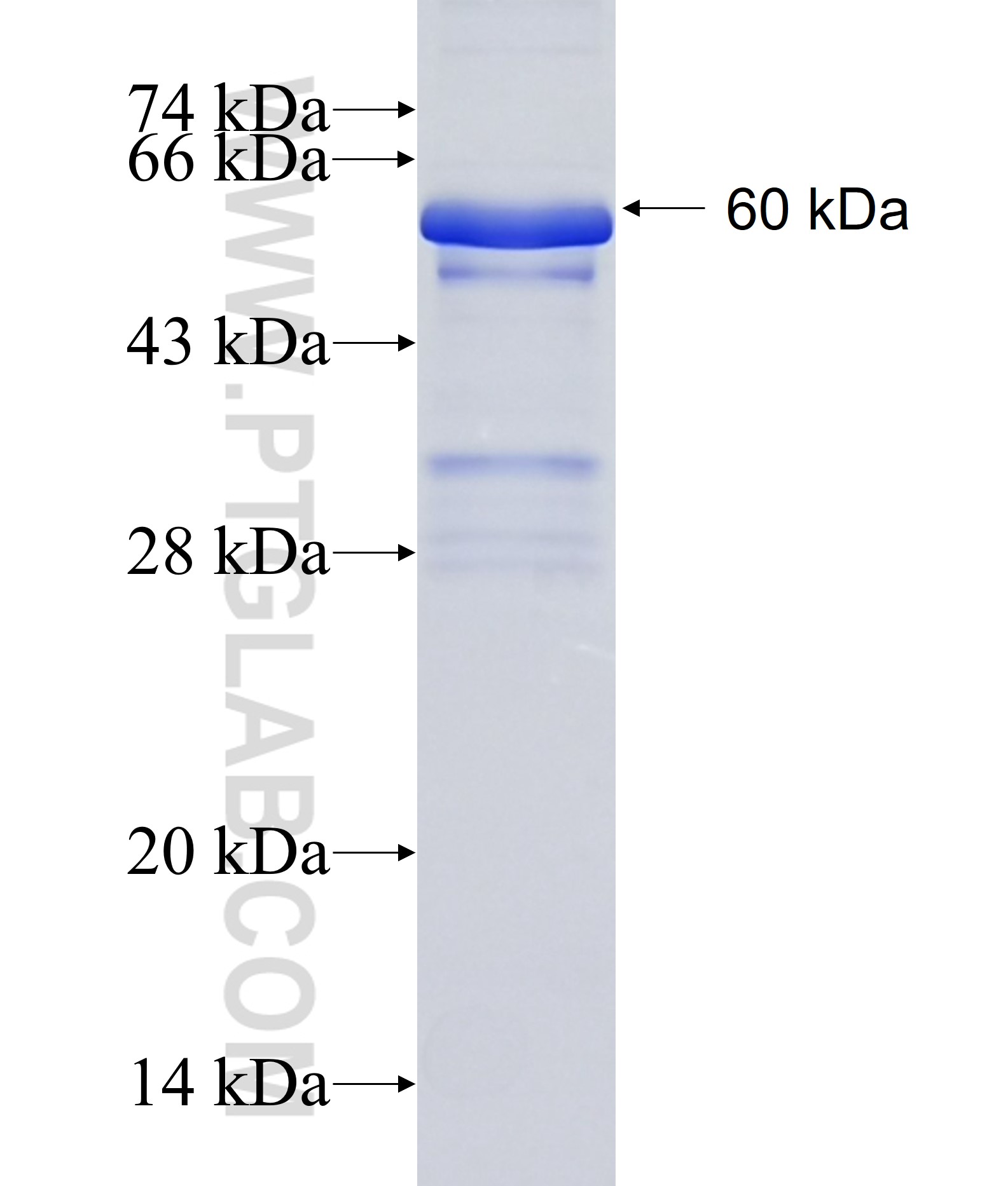 ZKSCAN3 fusion protein Ag14715 SDS-PAGE