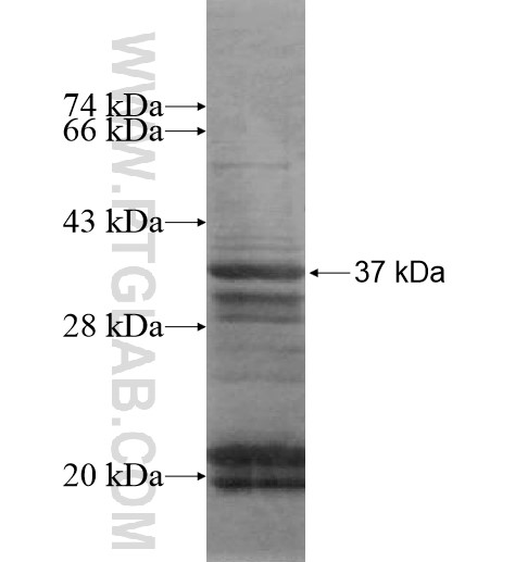 ZKSCAN3 fusion protein Ag14785 SDS-PAGE ZKSCAN3 fusion protein Ag14785 SDS-PAGE