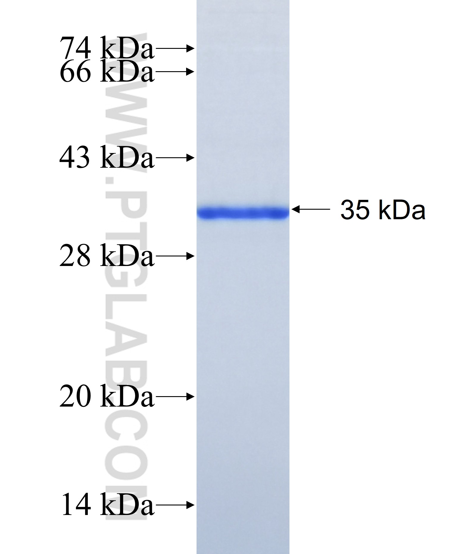 ZKSCAN4 fusion protein Ag41255 SDS-PAGE ZKSCAN4 fusion protein Ag41255 SDS-PAGE