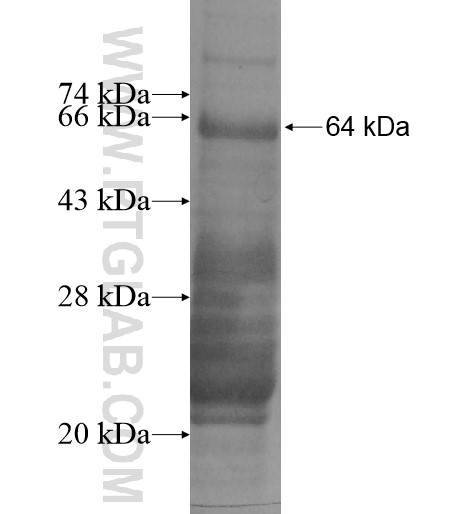 ZKSCAN5 fusion protein Ag14079 SDS-PAGE ZKSCAN5 fusion protein Ag14079 SDS-PAGE