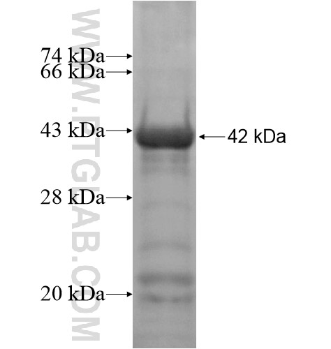 ZKSCAN5 fusion protein Ag14427 SDS-PAGE ZKSCAN5 fusion protein Ag14427 SDS-PAGE