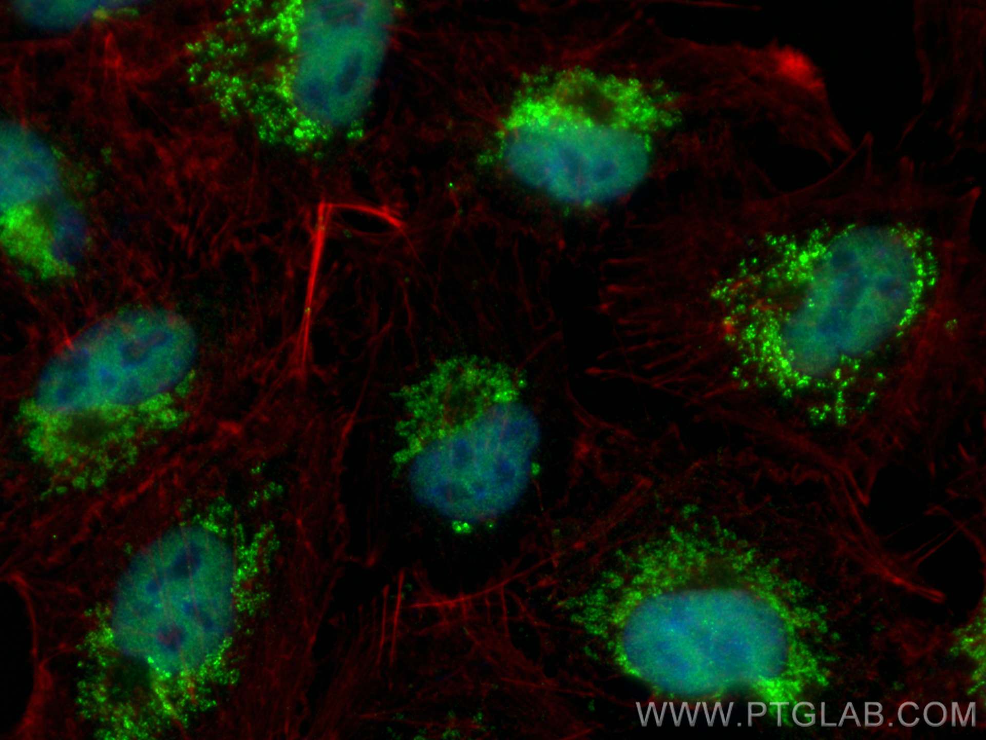 IF Staining of A549 using 16159-1-AP