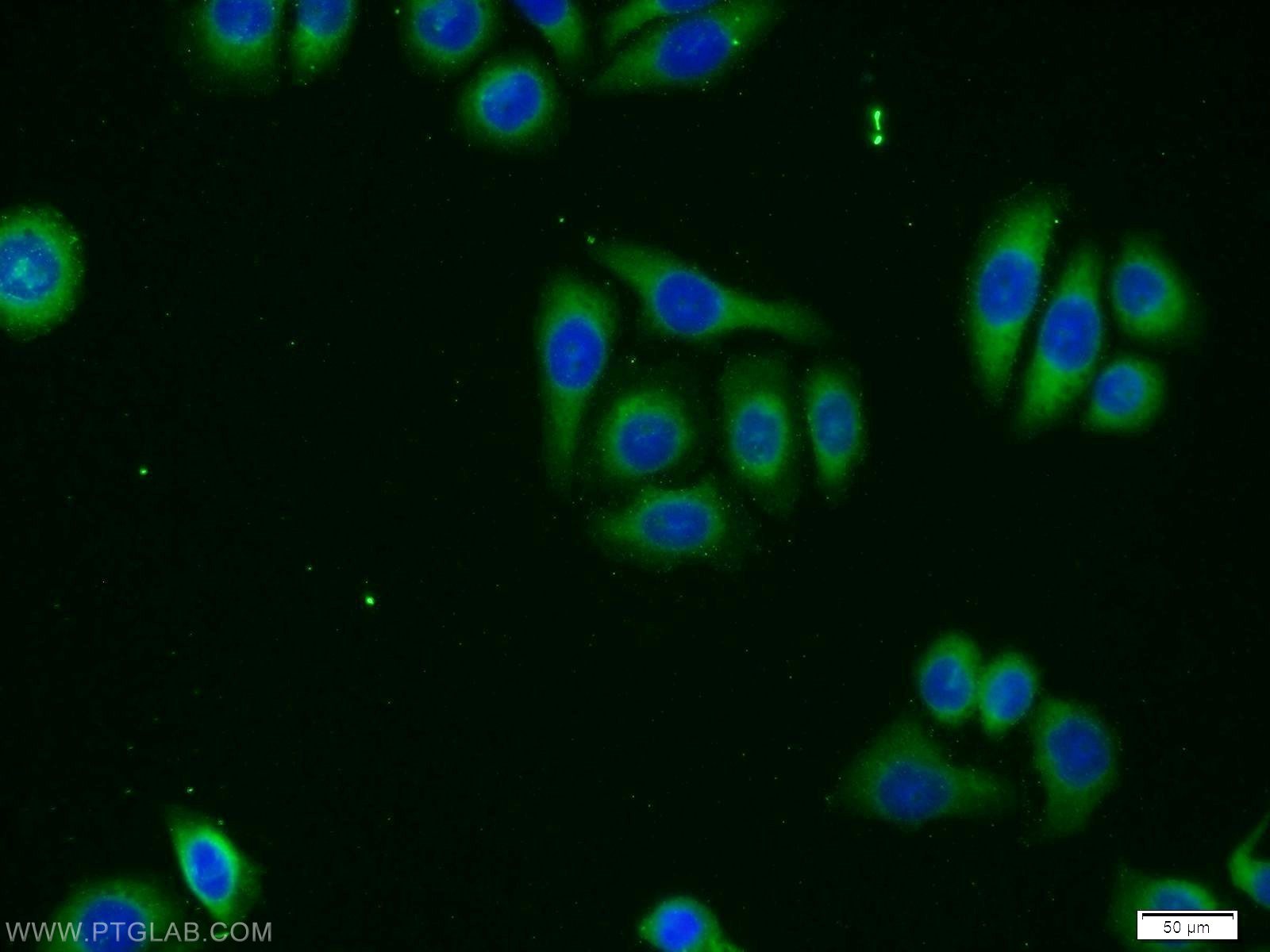 IF Staining of PC-3 using 12847-1-AP