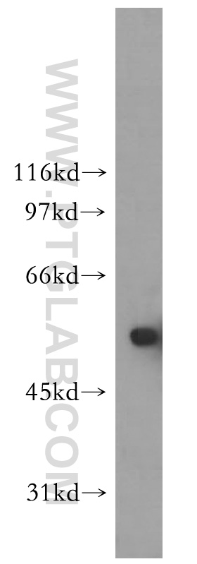 ZMPSTE24 Polyclonal antibody