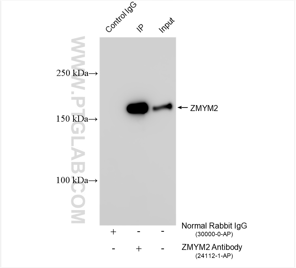 IP experiment of Raji using 24112-1-AP