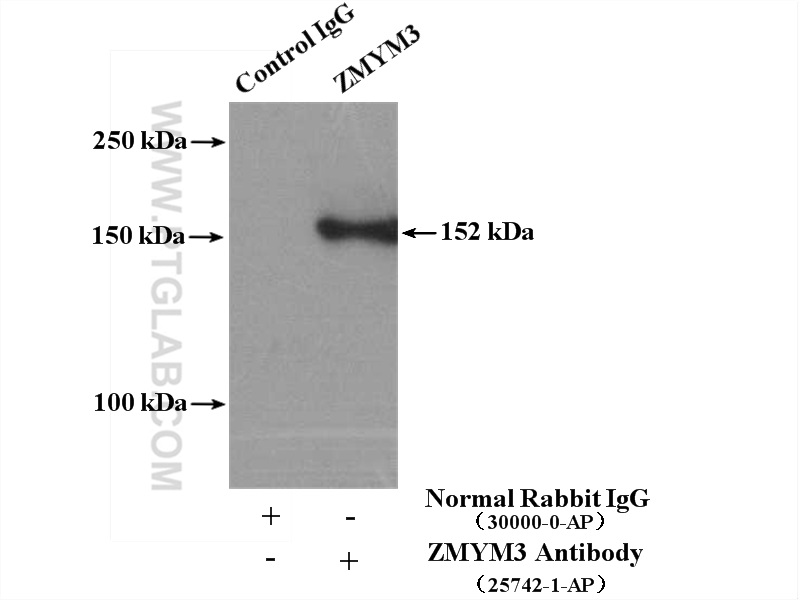 IP experiment of K-562 using 25742-1-AP