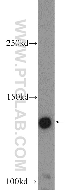 WB analysis of mouse brain using 25742-1-AP