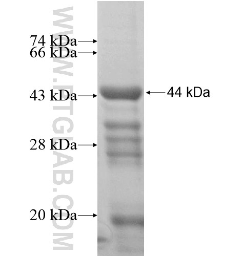 ZMYM4 fusion protein Ag15401 SDS-PAGE ZMYM4 fusion protein Ag15401 SDS-PAGE