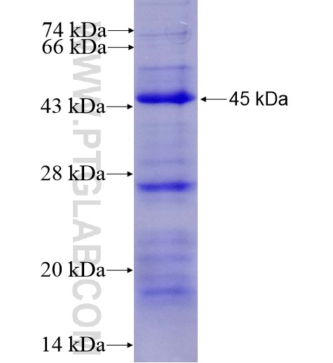 ZMYND11 fusion protein Ag14643 SDS-PAGE ZMYND11 fusion protein Ag14643 SDS-PAGE