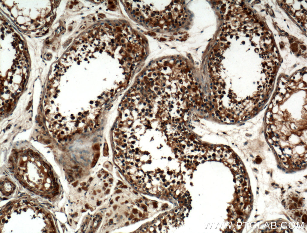 IHC staining of human testis using 25587-1-AP