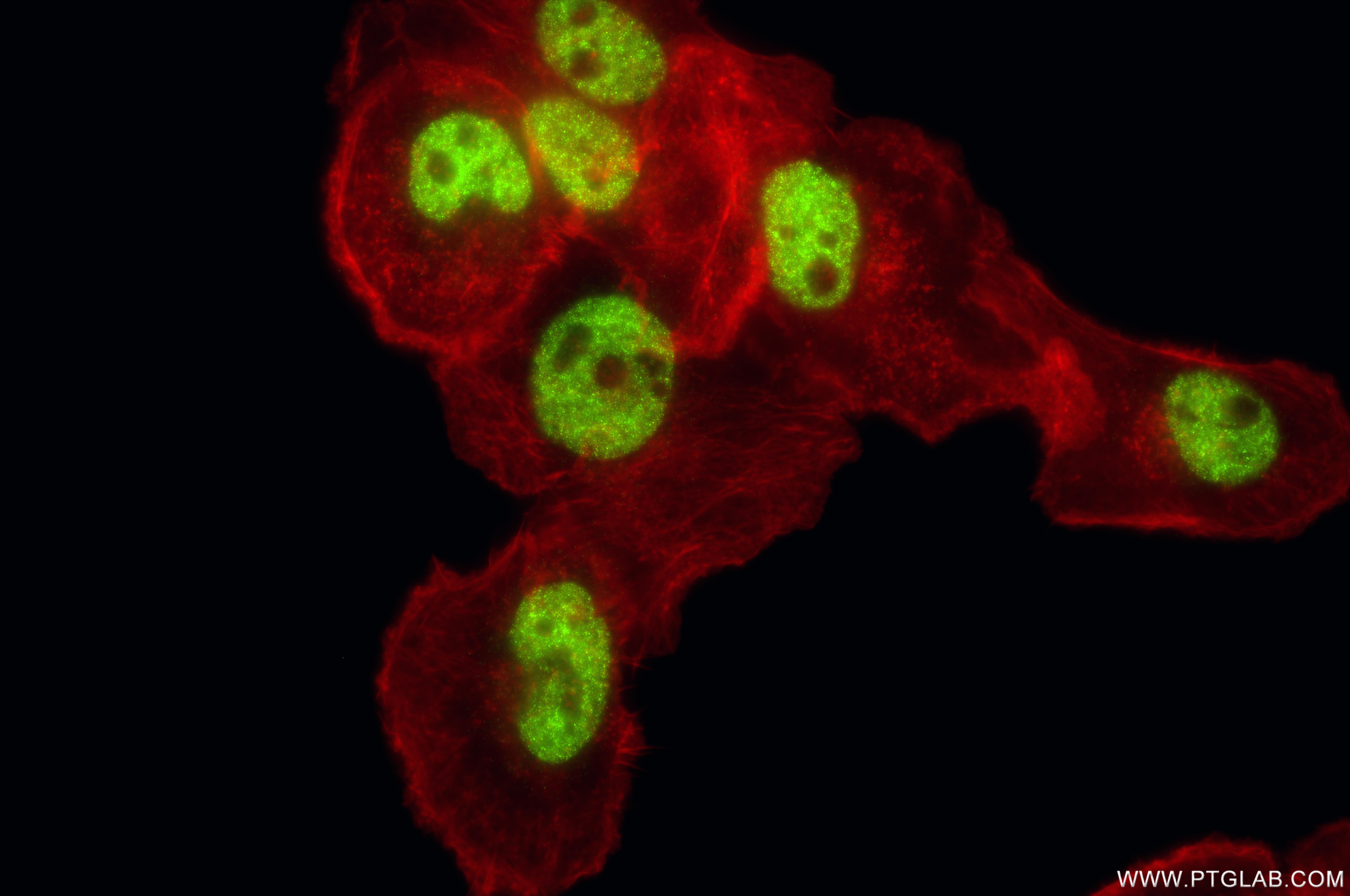IF Staining of A431 using 86901-1-RR (same clone as 86901-1-PBS)