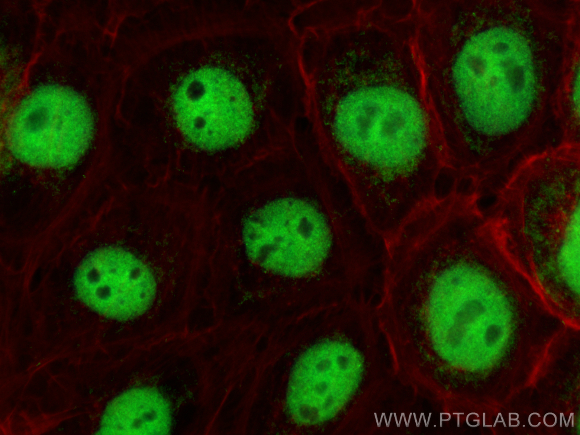 IF Staining of A431 using 25216-1-AP