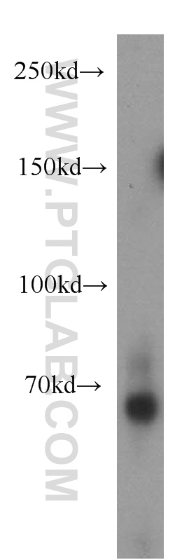 WB analysis of human testis using 21681-1-AP