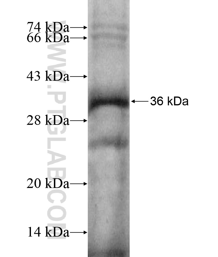 ZNF132 fusion protein Ag17373 SDS-PAGE ZNF132 fusion protein Ag17373 SDS-PAGE