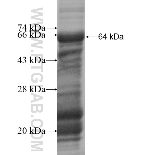 ZNF136 fusion protein Ag14738 SDS-PAGE ZNF136 fusion protein Ag14738 SDS-PAGE