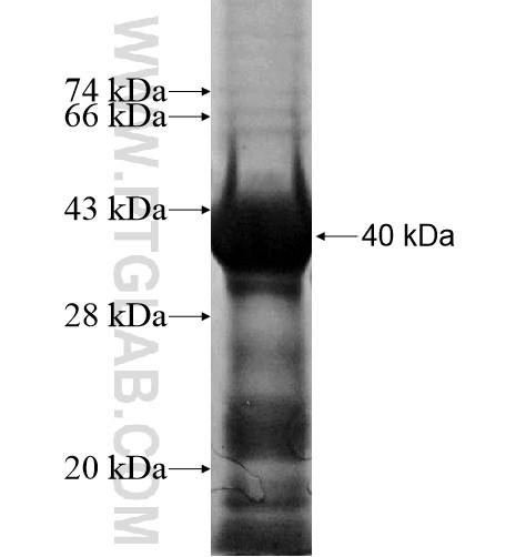ZNF136 fusion protein Ag15423 SDS-PAGE ZNF136 fusion protein Ag15423 SDS-PAGE
