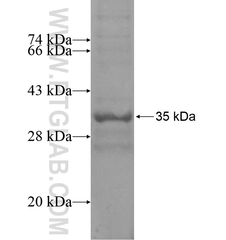 ZNF137 fusion protein Ag16433 SDS-PAGE ZNF137 fusion protein Ag16433 SDS-PAGE