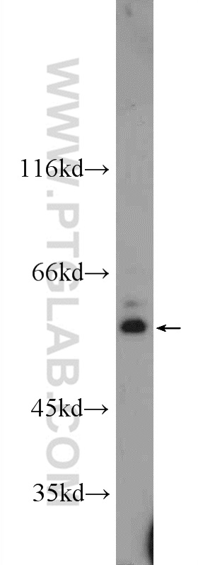 ZNF140