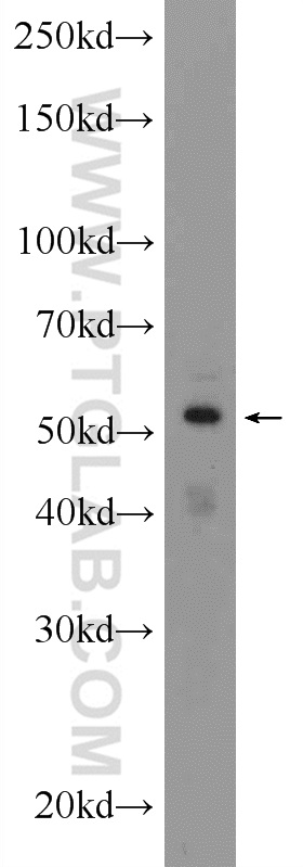 WB analysis of SKOV-3 using 24531-1-AP