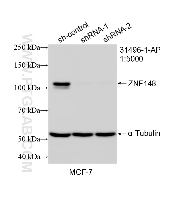 WB result of ZNF148 antibody (31496-1-AP; 1:5000; incubated at room temperature for 1.5 hours) with sh-Control and sh-ZNF148 transfected MCF-7 cells. WB analysis of MCF-7 using 31496-1-AP