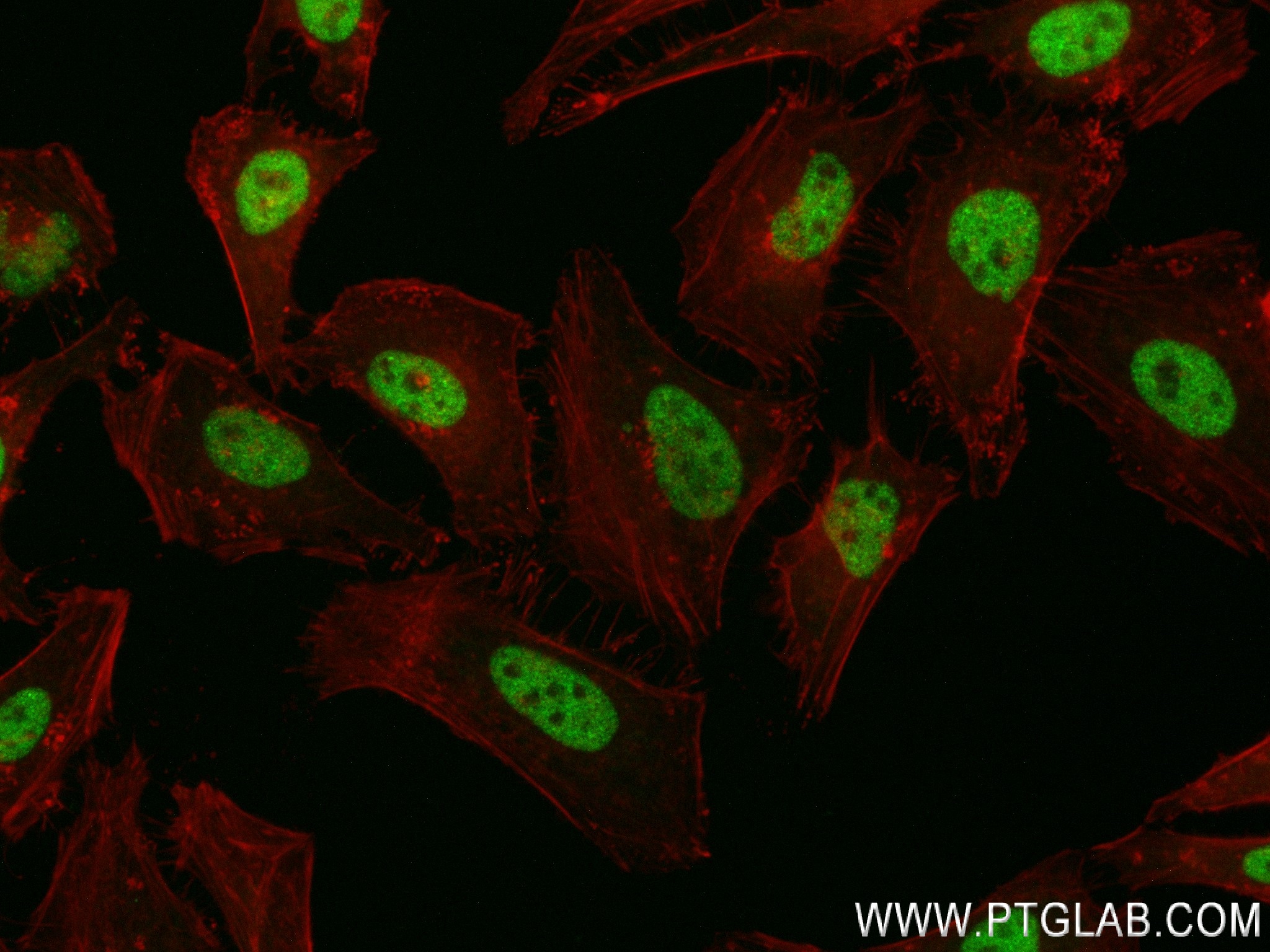 IF Staining of HeLa using 84338-6-RR (same clone as 84338-6-PBS)