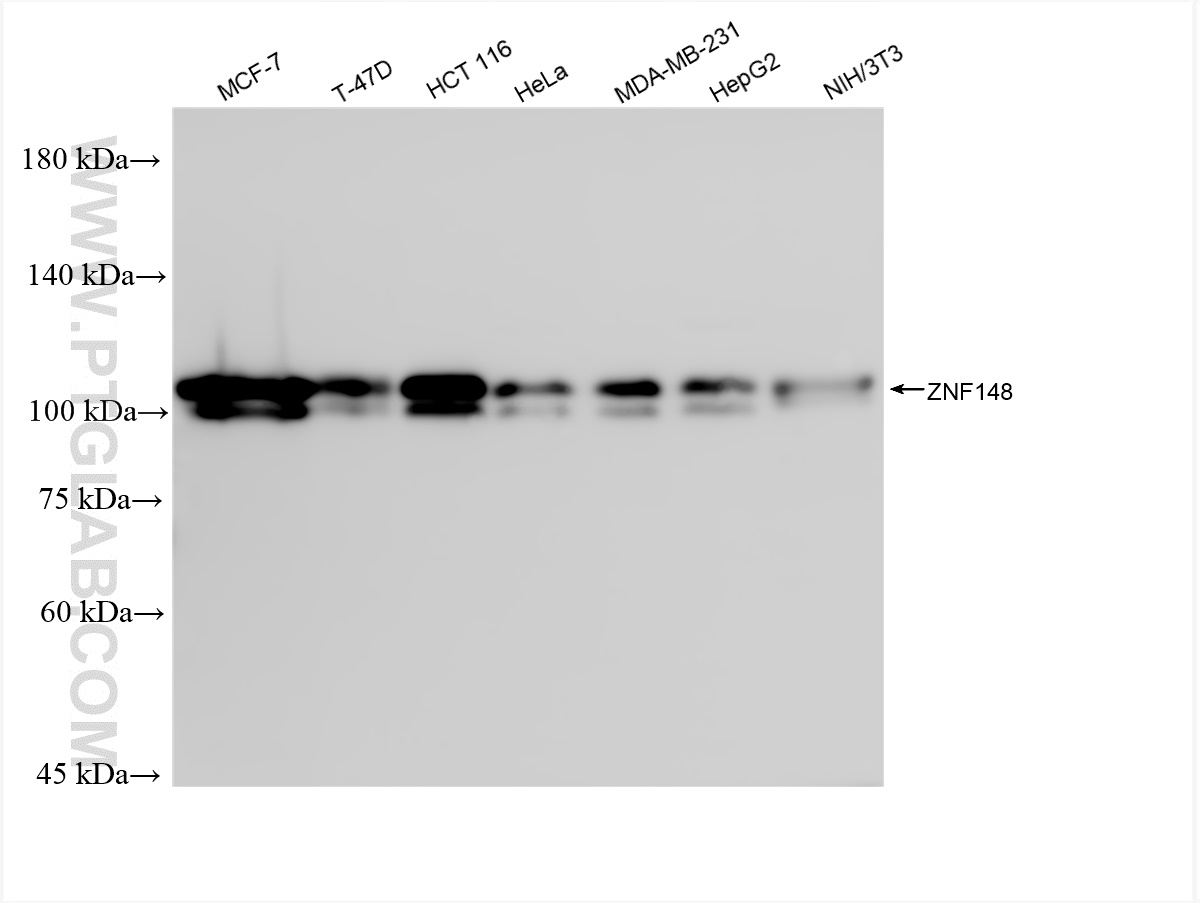 WB analysis using 84338-7-RR (same clone as 84338-7-PBS)