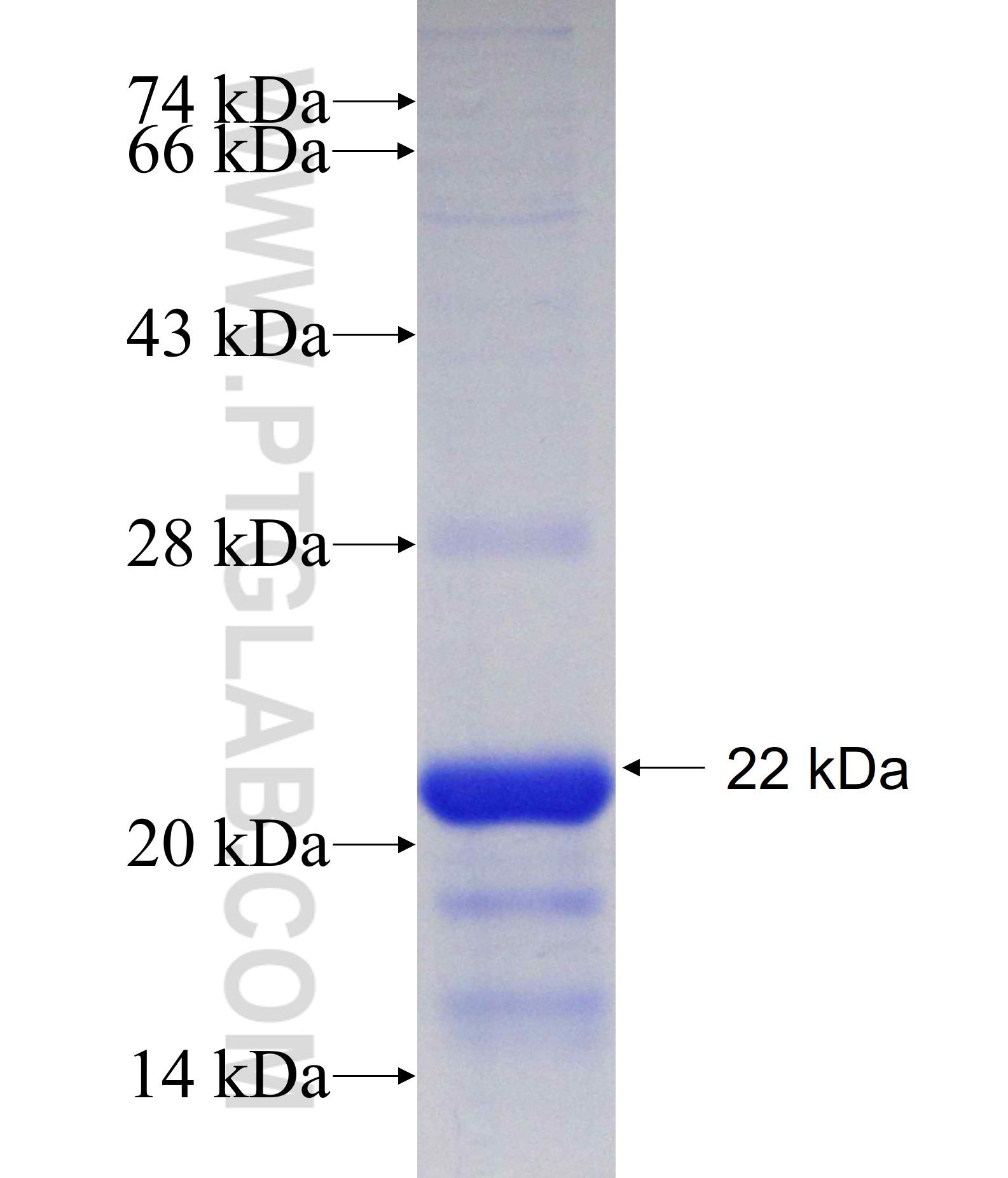ZNF154 fusion protein Ag17896 SDS-PAGE ZNF154 fusion protein Ag17896 SDS-PAGE