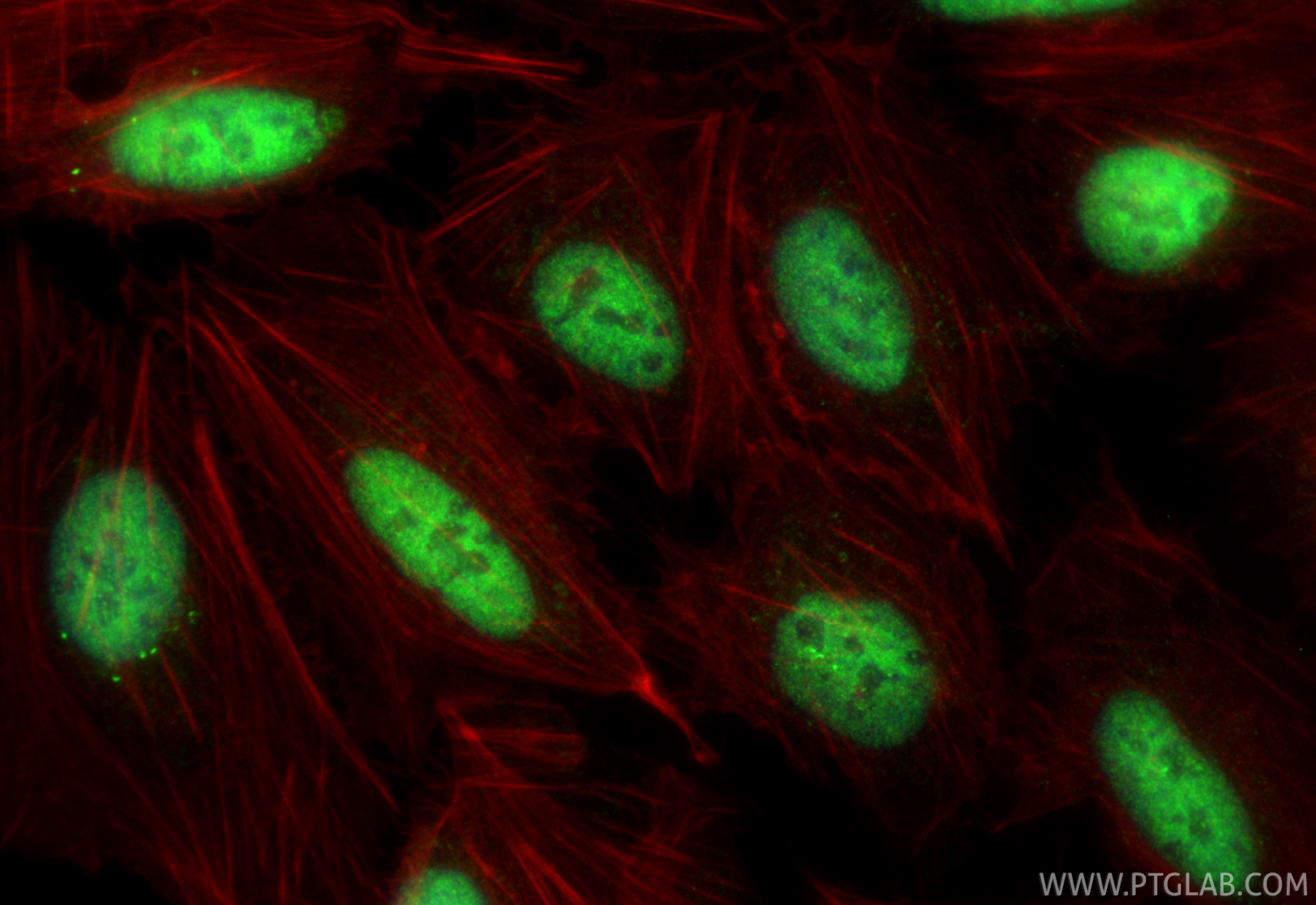 IF Staining of U2OS using 33838-1-AP