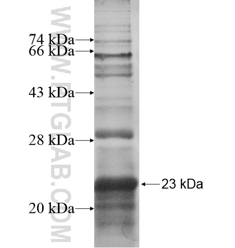 ZNF160 fusion protein Ag12946 SDS-PAGE ZNF160 fusion protein Ag12946 SDS-PAGE
