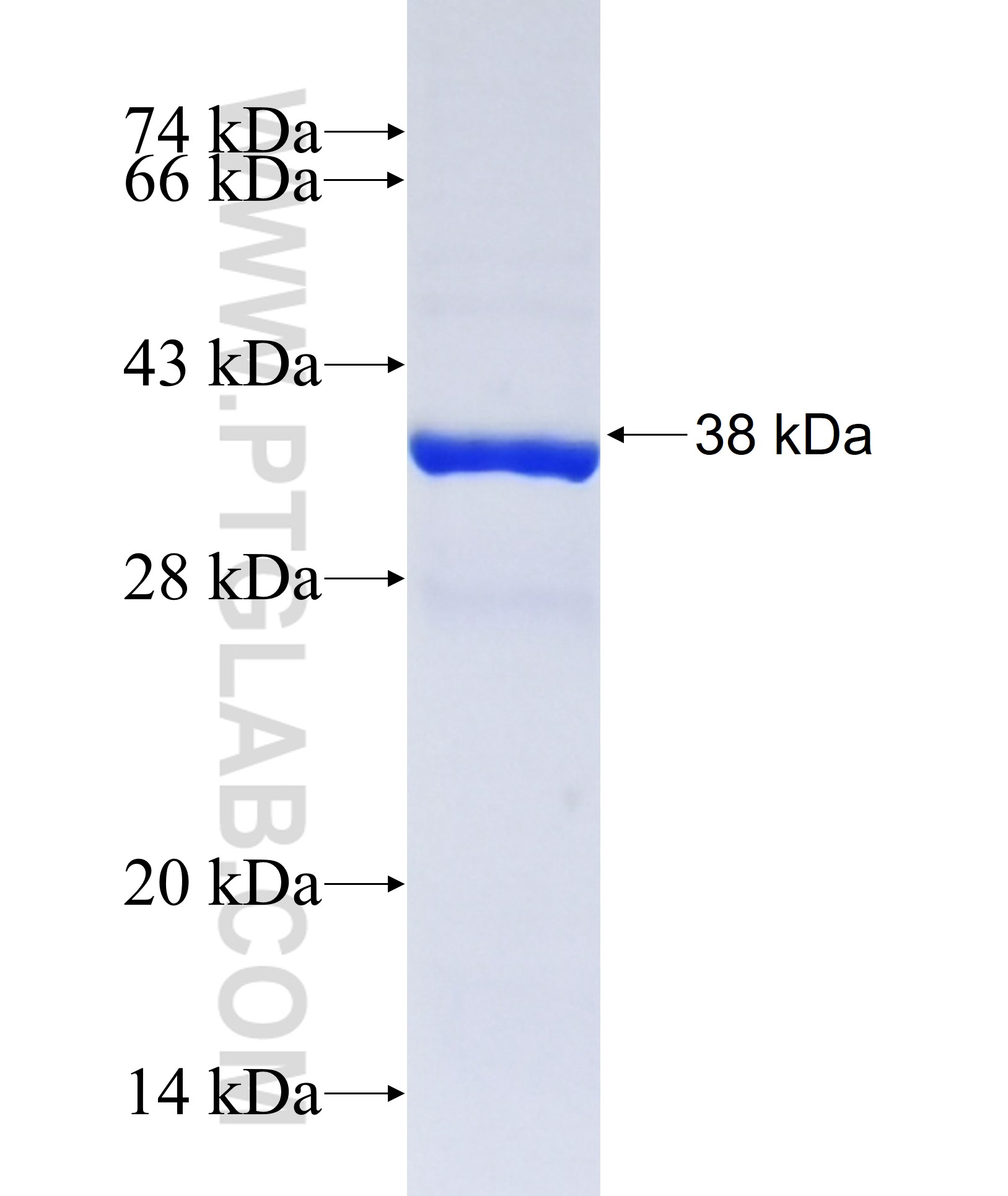 ZNF177 fusion protein Ag38127 SDS-PAGE ZNF177 fusion protein Ag38127 SDS-PAGE